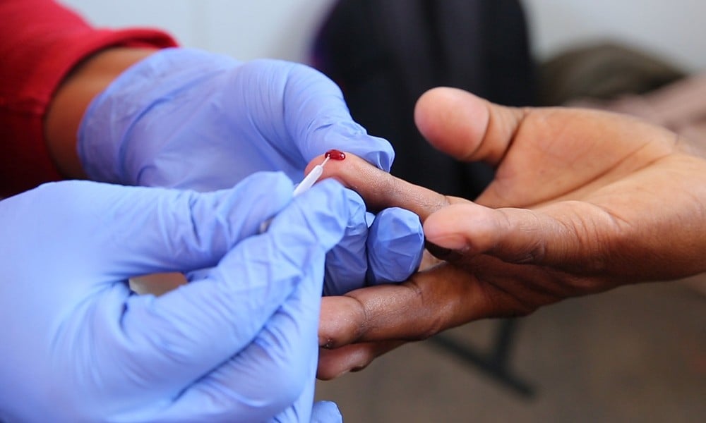 Steps for Confidential HIV Testing in Dubai HIV Testing